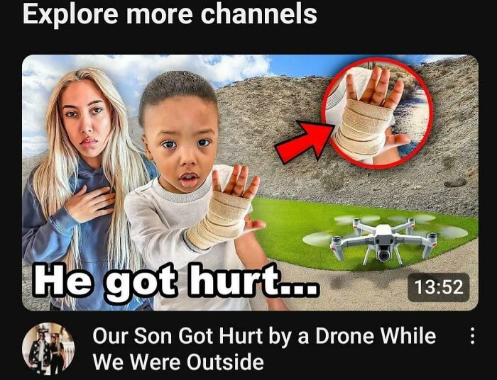 Young boy with a bandaged hand next to a woman and a drone, highlighting cringy influencers ignoring safety rules.