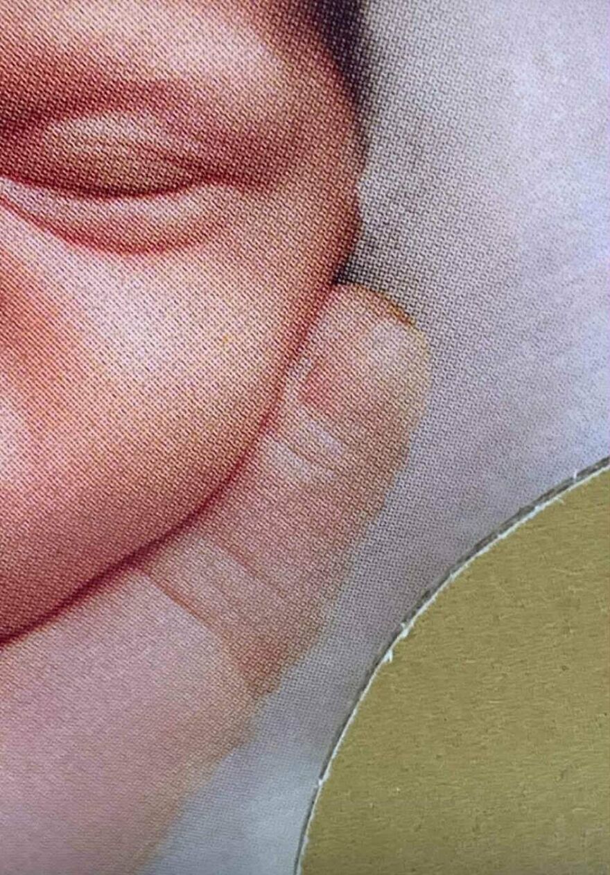 Close-up of a baby's hand with a finger showing a strange, unexplainable visual effect on textured fabric background.