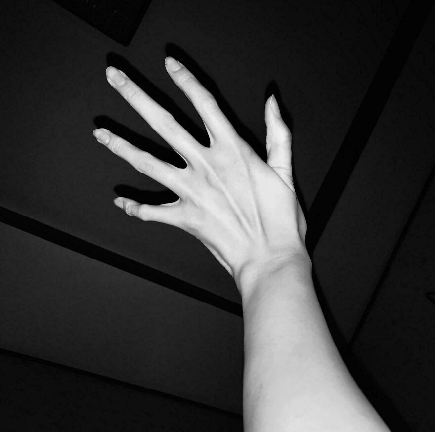 Pale hand with an unusual number of fingers extended against a dark ceiling background, showcasing weird and unexplainable phenomenon.