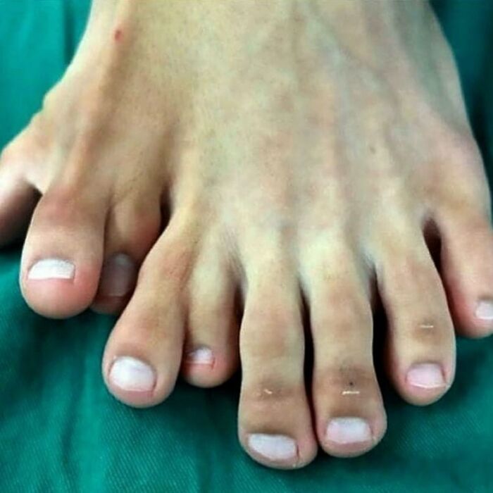 Close-up of human toes and toenails resting on a green surface showing natural skin texture and nail details.