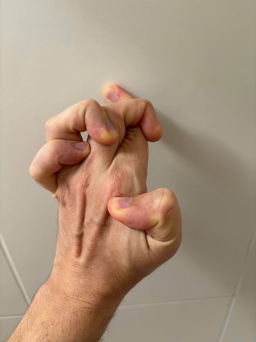 A close-up of a hand with fingers unusually bent and intertwined, showing weird and unexplainable things experienced.