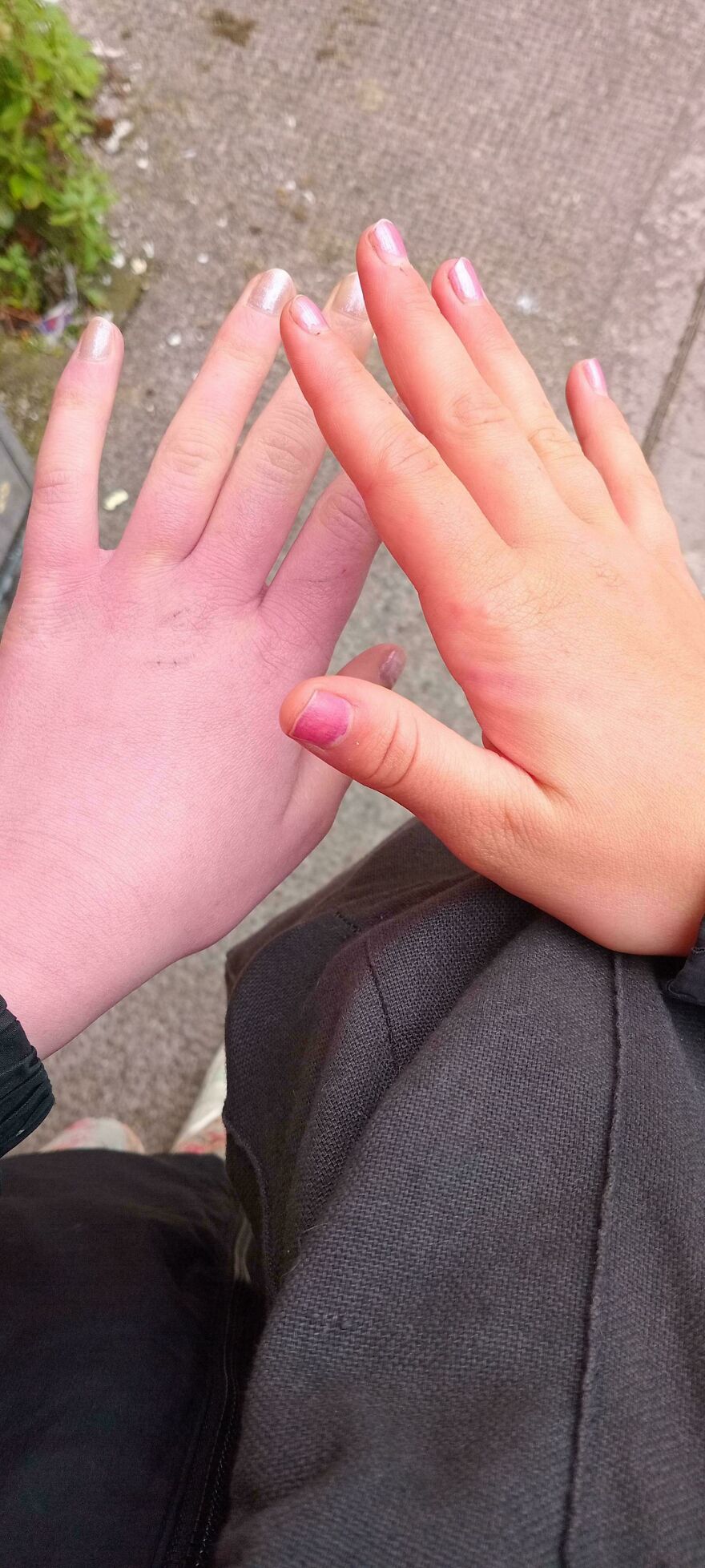 Two hands with distinctly different skin tones and nail colors side by side showing weird and unexplainable differences.