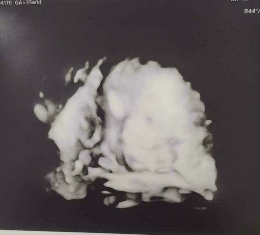 3D ultrasound image showing a bizarre and unexplainable shape resembling a face, part of weird things experienced.