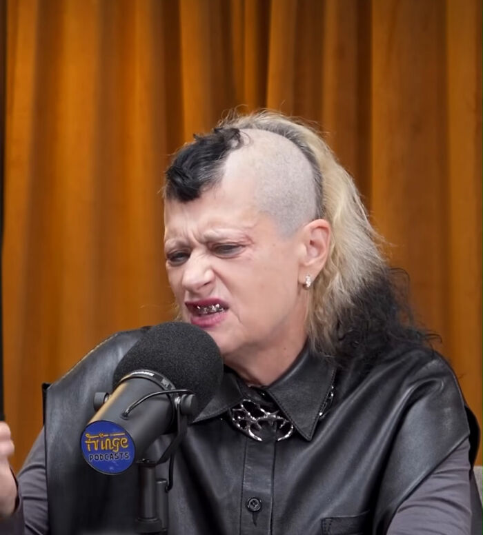 A person with a half-shaved head and long, blonde and black hair, an unfortunate haircut.