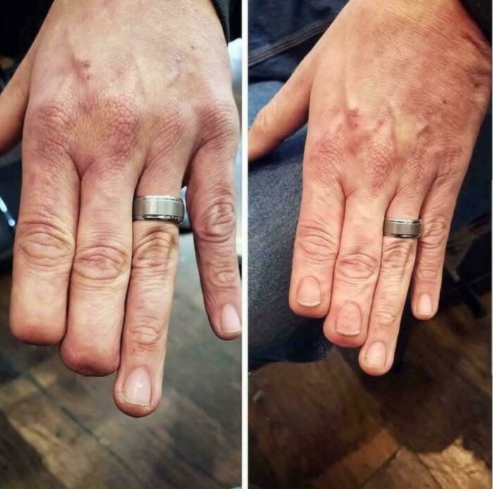 Amazing photos: Two side-by-side images of a hand wearing a silver ring, showcasing a before and after transformation.