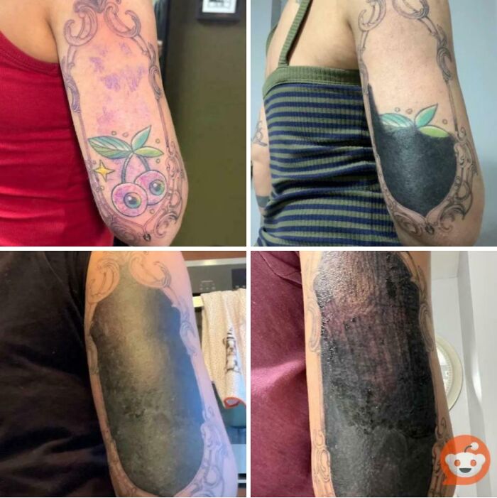 Four photos showing a tattoo cover-up process on an arm, illustrating truly awful tattoos being transformed or hidden.