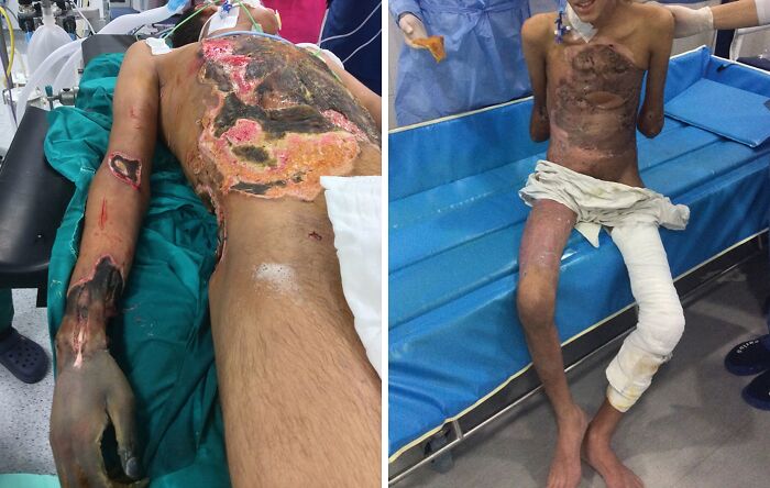 Severe medical burns and skin damage shown in unusual medical photos highlighting extreme cases between science and nightmare.