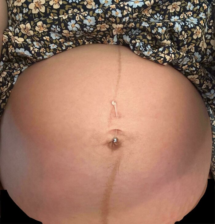 My Pregnancy Line Warped To Go Around My Piercing