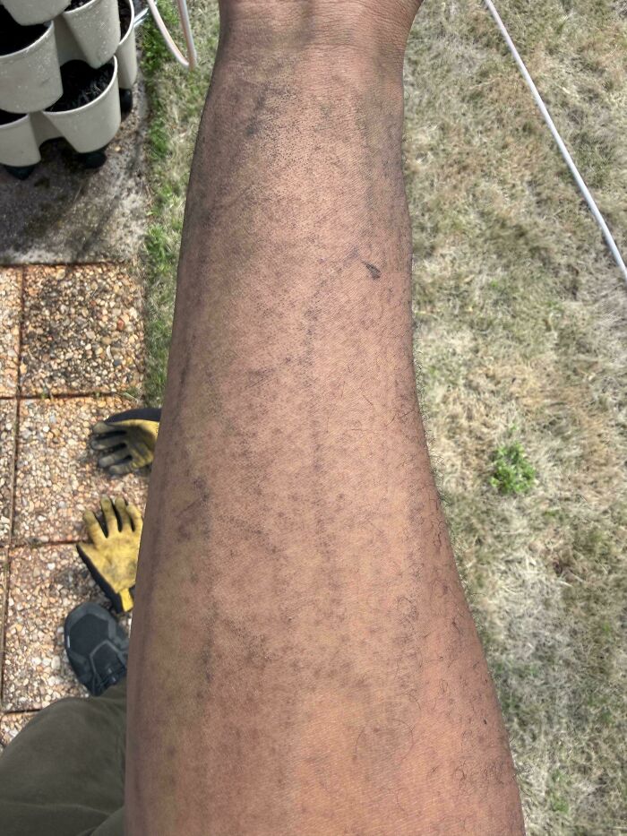 Garden Soil Followed The Path Of My Veins