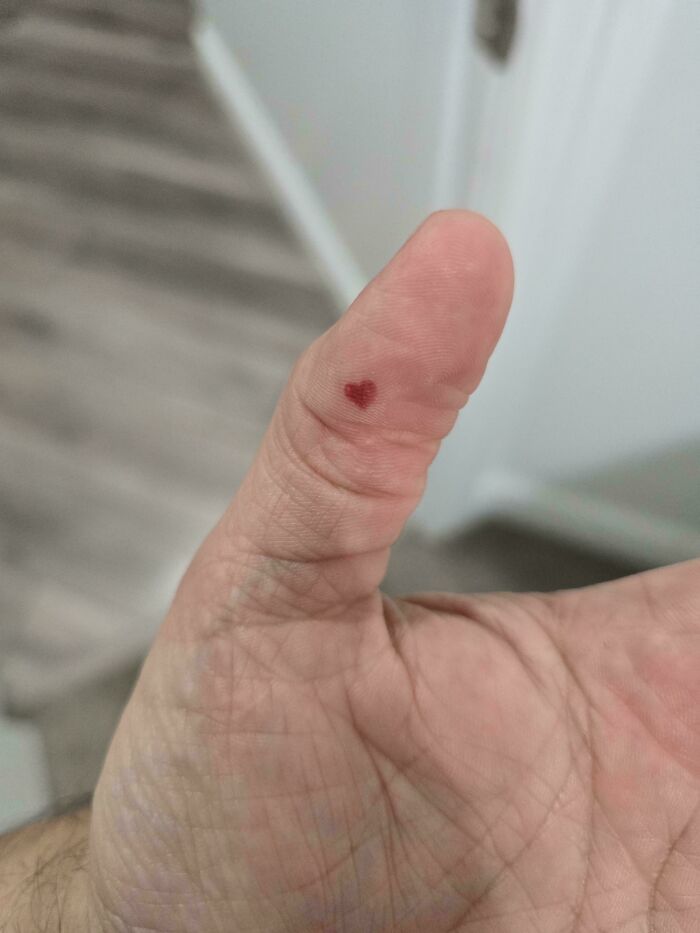 My Blood Blister Looks Like A Heart