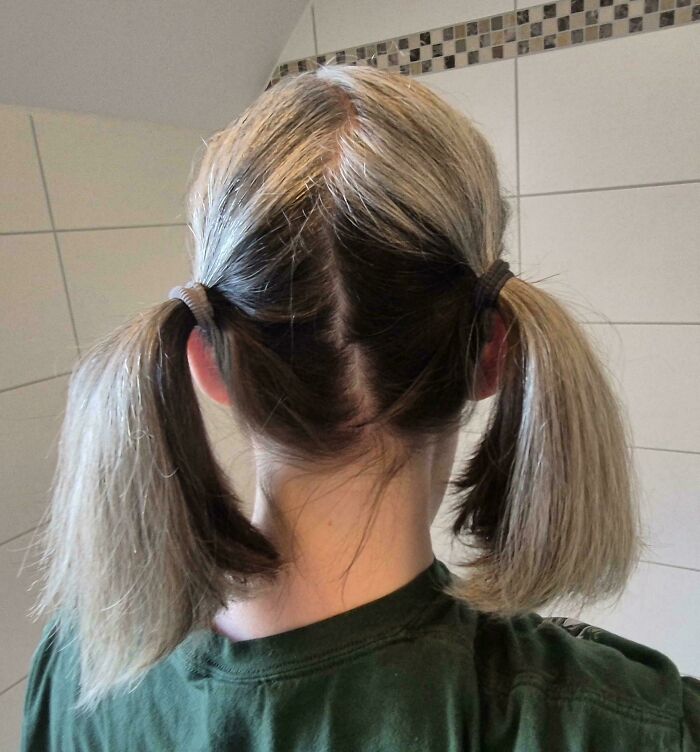 My Hair Is Only Gray/White On The Top