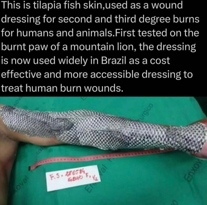 Tilapia fish skin used as a natural wound dressing for burns, showcasing an innovative treatment in explaining the wild facts.