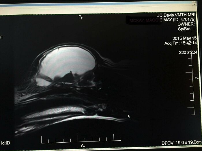 MRI scan showing a strange and unexplainable image that may linger in your brain longer than you want.
