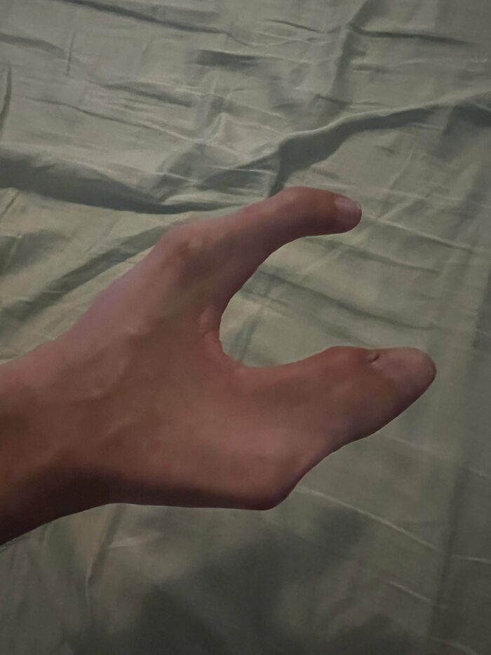 Unexplainable image showing a foot shaped like a hand with toes mimicking fingers on a gray fabric background.