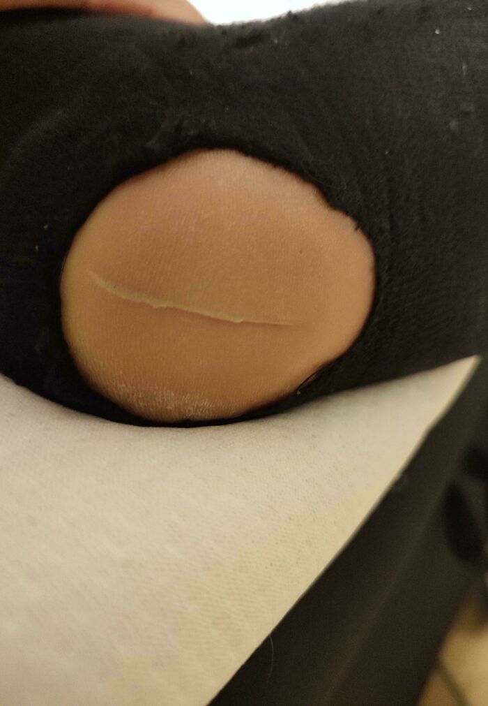 Close-up of a worn-out sock with a hole showing a toe, one of the weird and unexplainable images.