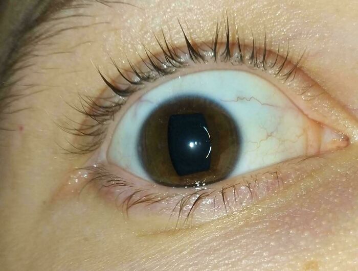 Close-up of a brown eye with an unusual rectangular pupil shape, one of the weird and unexplainable images.