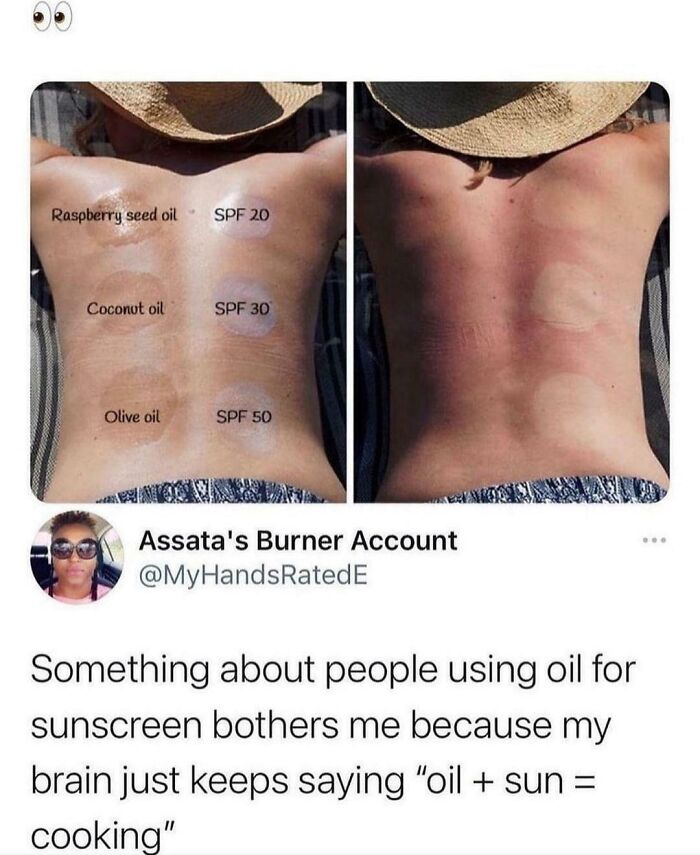 Comparison of skin sunburn from using raspberry seed, coconut, and olive oils versus SPF sunscreen showing internet favorite moments.