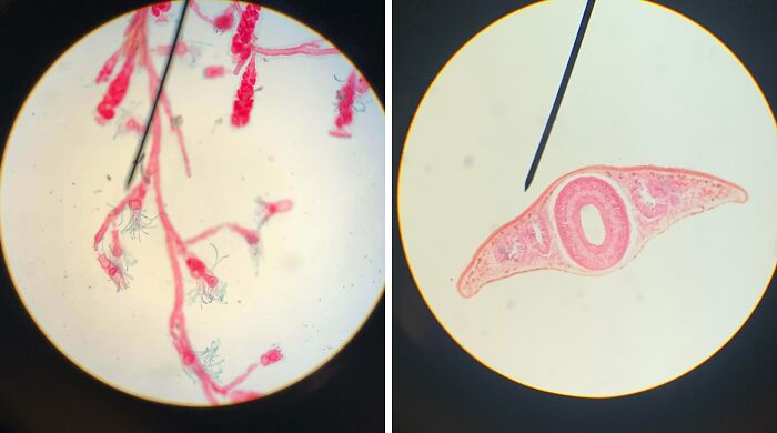 I’m Taking Zoology And I Thought I Would Share Some Of The Stuff I’ve Looked At Under The Microscope