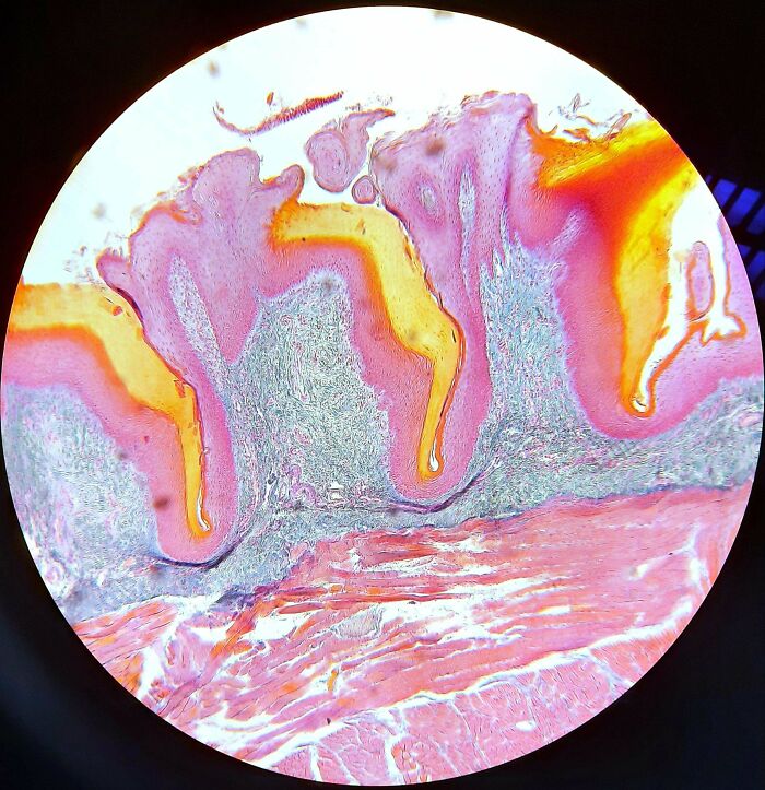 We Had To Work With 25 Year Old Samples, And If I Am Correct This Is A Tongue. I Find It Insane That Prepared Samples This Old Still Look This Goof Under A Microscope!