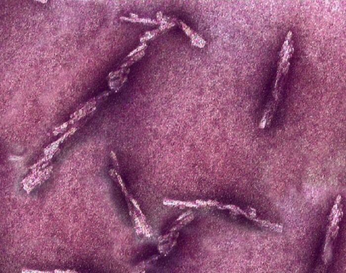 A False-Color, High-Res Microscopic View Of Prions