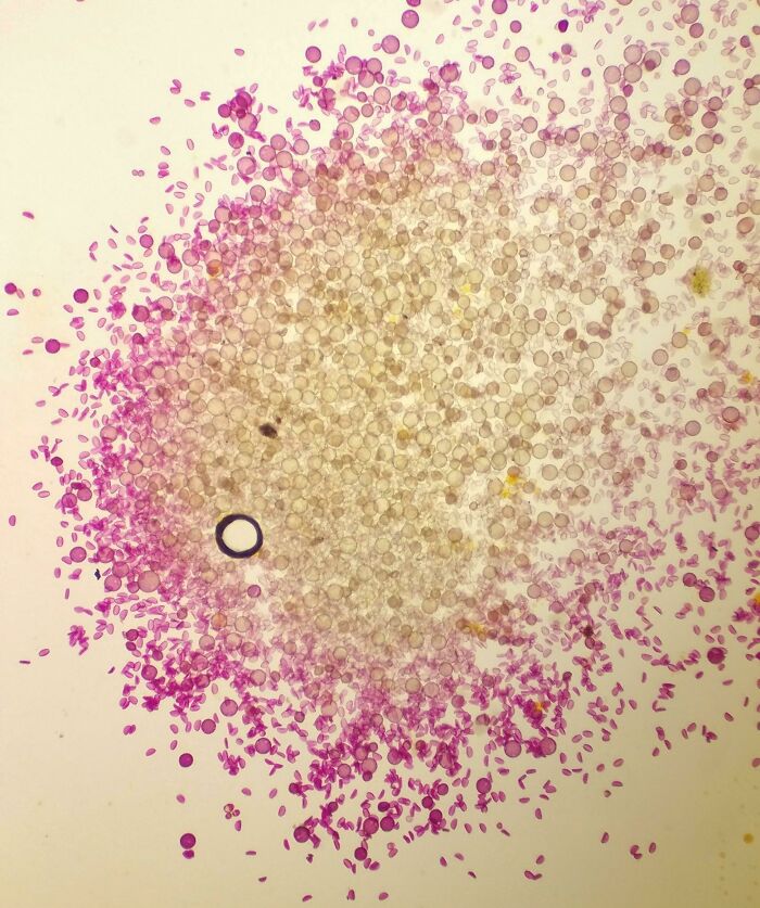 Pollen From A Bees Leg Under A Microscope