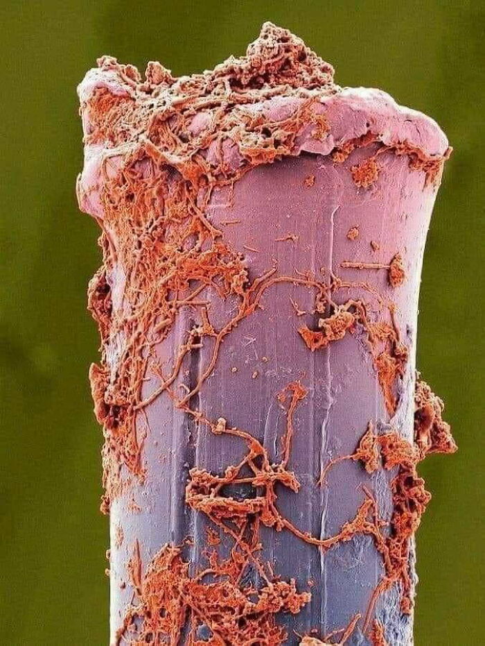 A Used Toothbrush Bristle Under An Electron Microscope