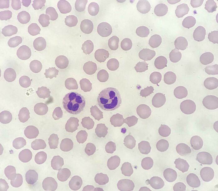 Perfect For The Spooky Month, Jack-O-Lantern Neutrophil