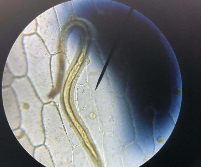 Found This Worm On A Slice Of Onion In Biology Class, Can Only Be Seen Under A Microscope
