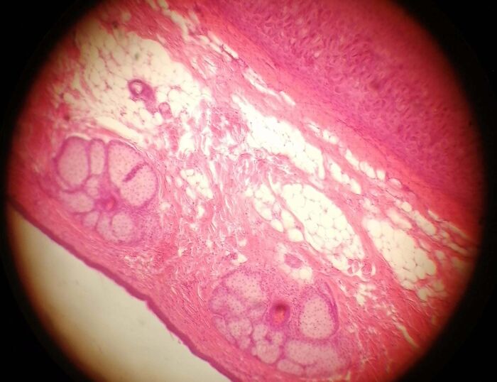 Musculoskeletal Tissue Lab Practical-Some Pics From The Microscope
