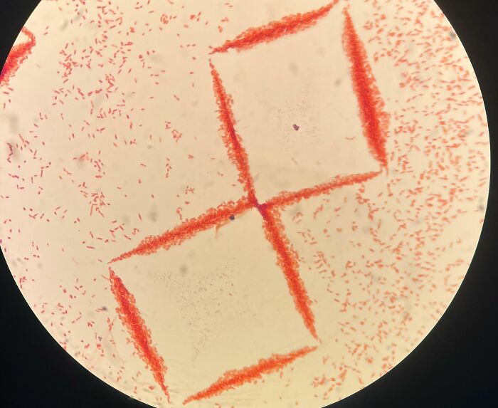 Interesting Arrangements Of E. Coli Under Microscope