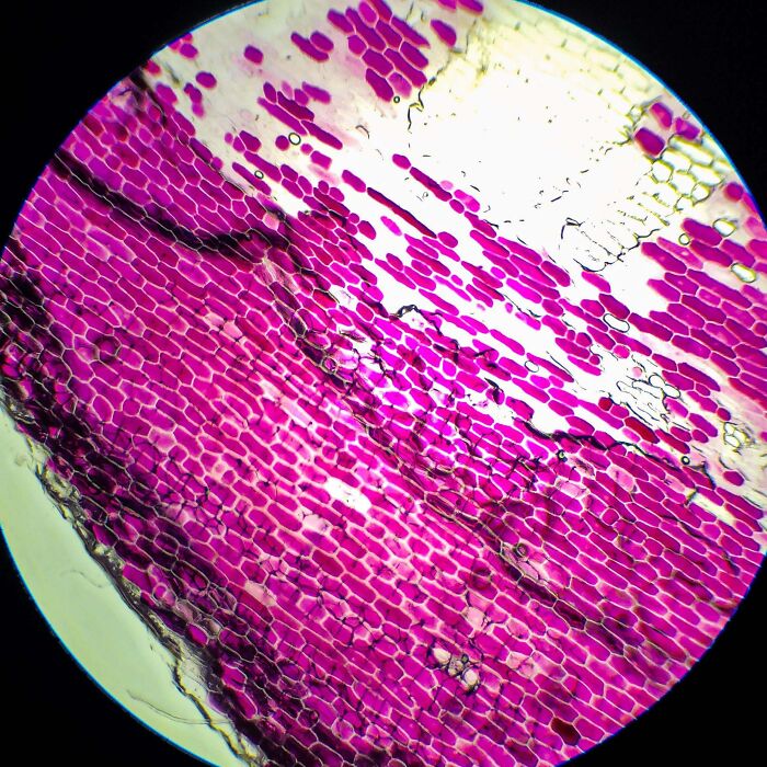 Plasmolized Red Onion Cells Under Microscope