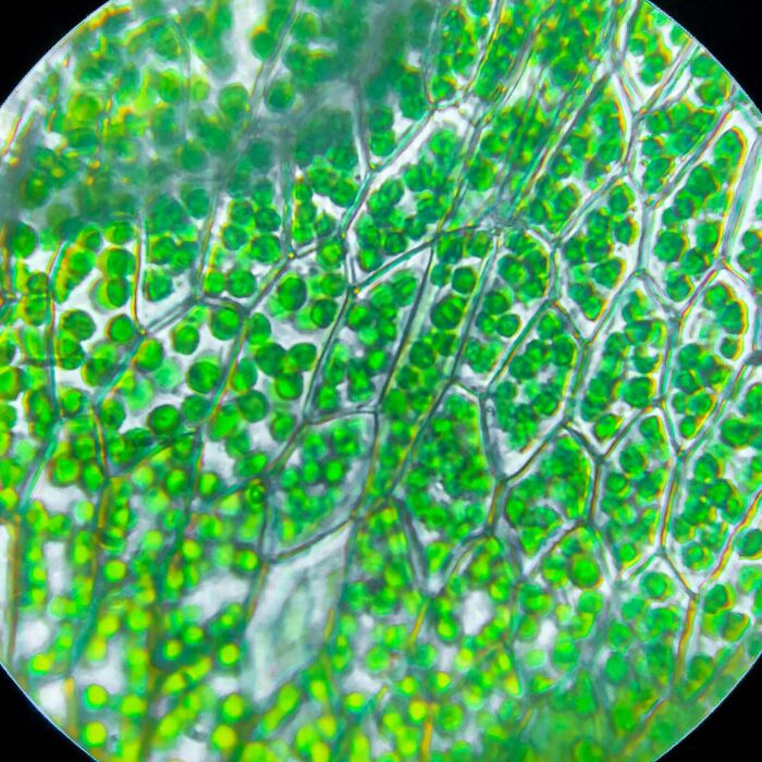 Took Some Pictures Of Chloroplasts Under The Microscope