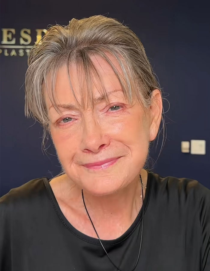 Grandma smiling after a miracle plastic surgeon&rsquo;s transformation to look decades younger in a black top with short gray hair.