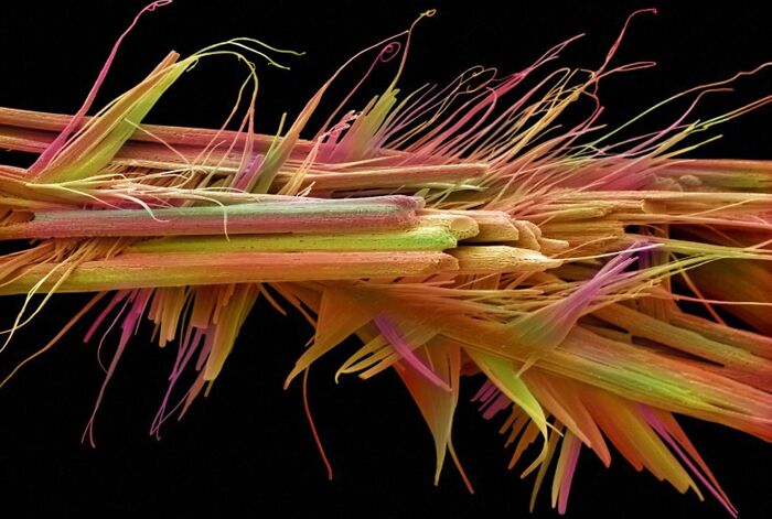 Caffeine Crystals Under A Microscope