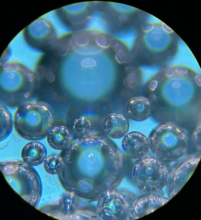 My Saliva Through My Sons Microscope