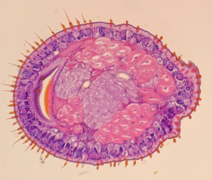 Microscopic Cross-Section Of The Leg Of A Red Centipede