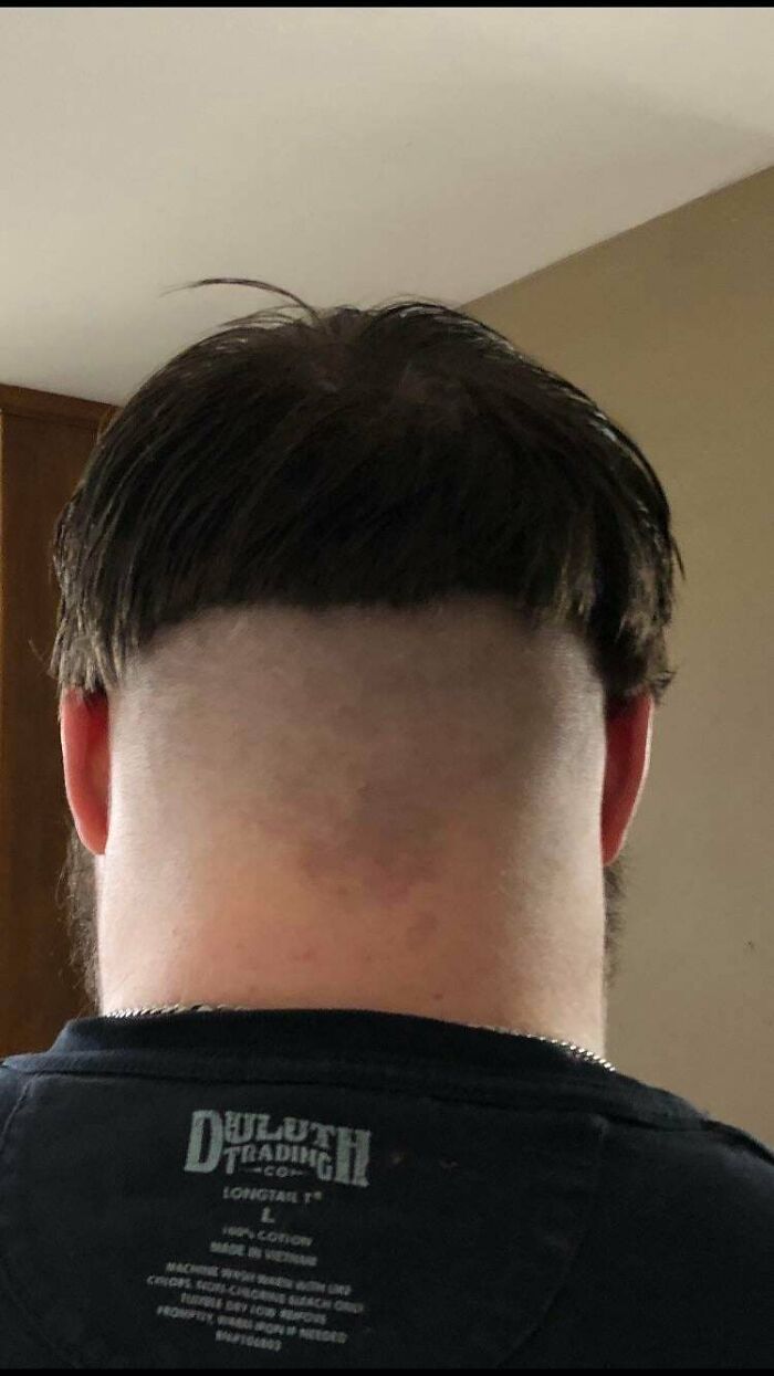 The back of a man's head, showing a very short, unfortunate haircut with a straight line.