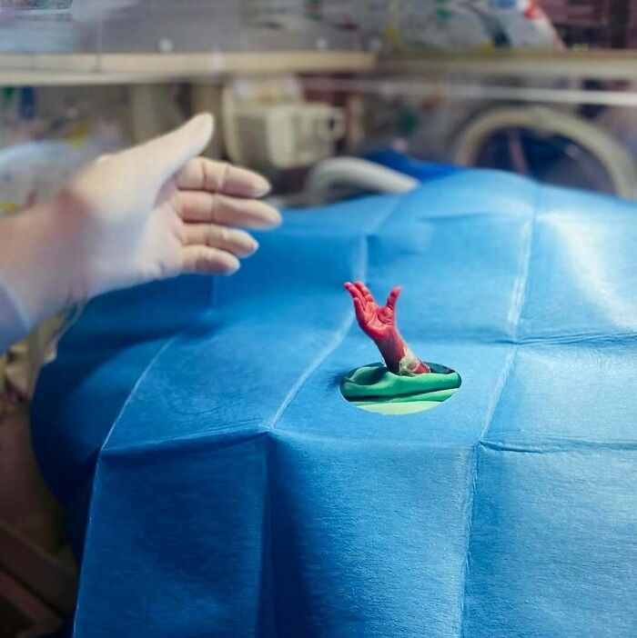 Premature newborn’s tiny red hand reaching through medical drape during an unusual medical procedure in a clinical setting.