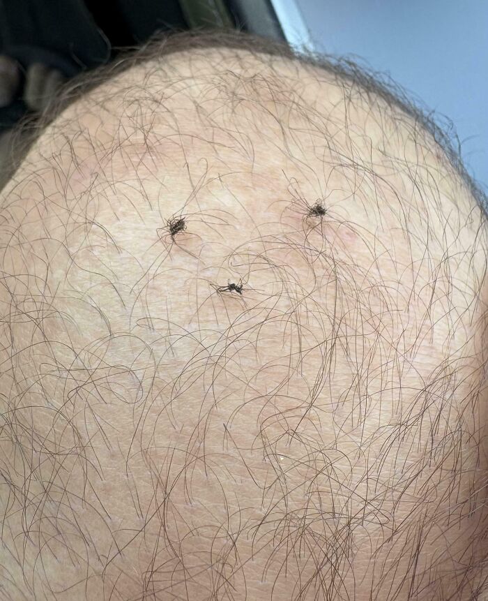 The Hair On My Right Knee Sometimes Knots Up