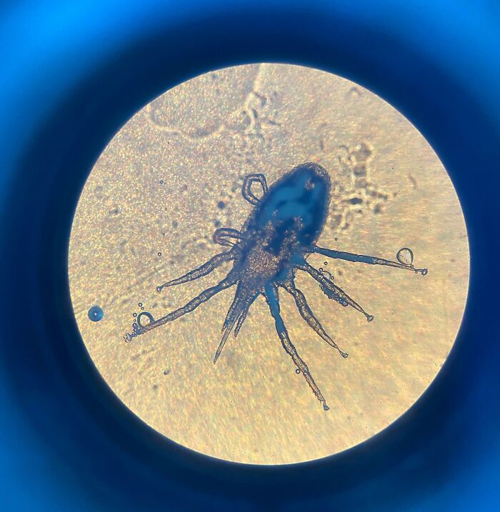 Sitting In Bed, Felt A Bite, Saw This Little Guy Crawling On Me. Threw Him Under The Microscope