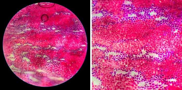 I Took Some Pictures Of A Rose Under The Microscope