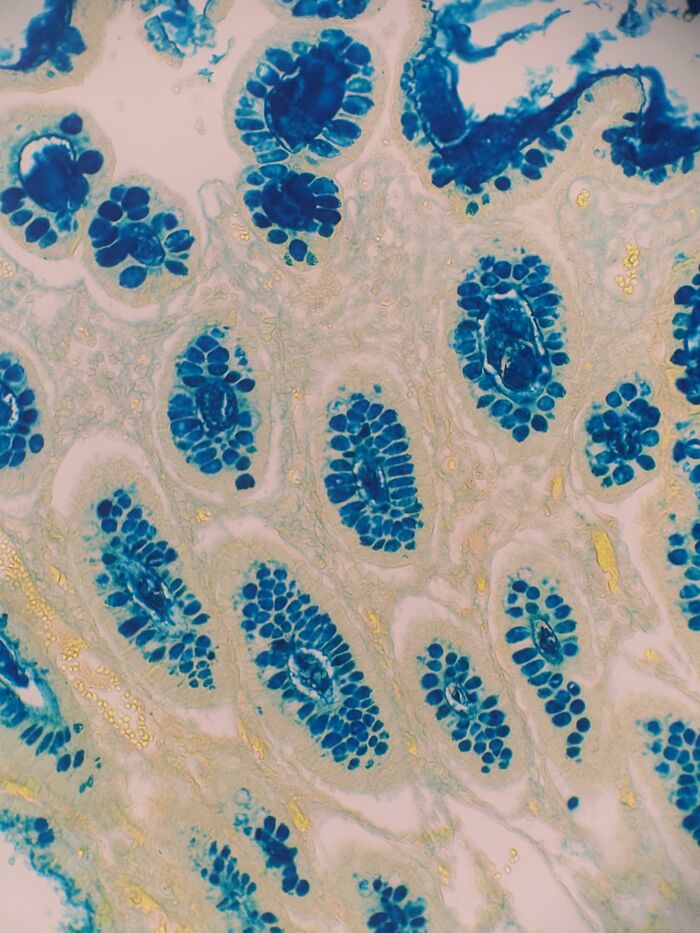 The Colloidal Iron Tissue Stain Utilizes Prussian Blue Chemical Reaction To Stain Acidic Mucin Secretions With Prussian Blue Color For Viewing Under A Microscope