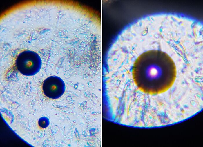 Got A New Microscope And Had A Look At My Partners Saliva