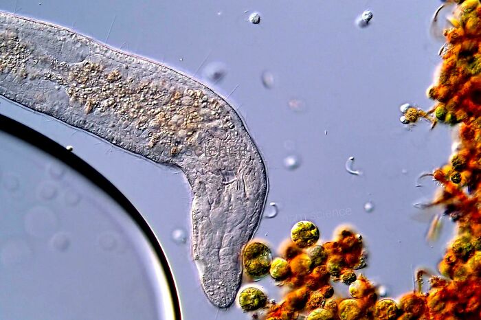 Freshwater Flatworms Under DIC Microscope