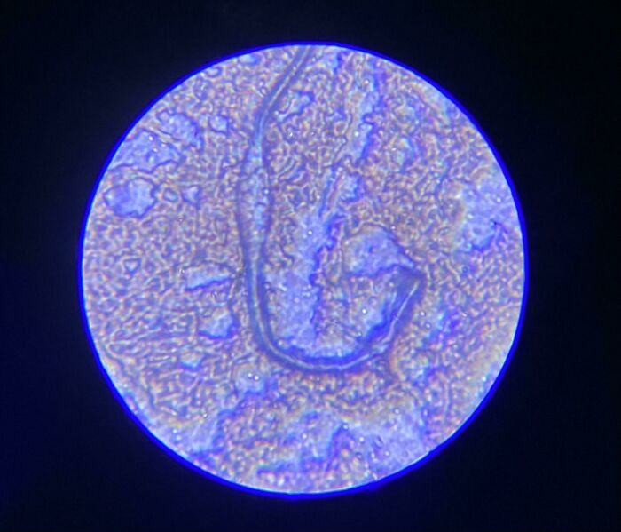 Was Playing Around With My Son’s New Microscope. Decided To Look At A Drop Of My Blood