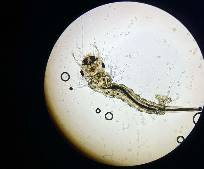 Here Is A Close Up Of A Misquote Larva Under A Microscope. Looks Vicious