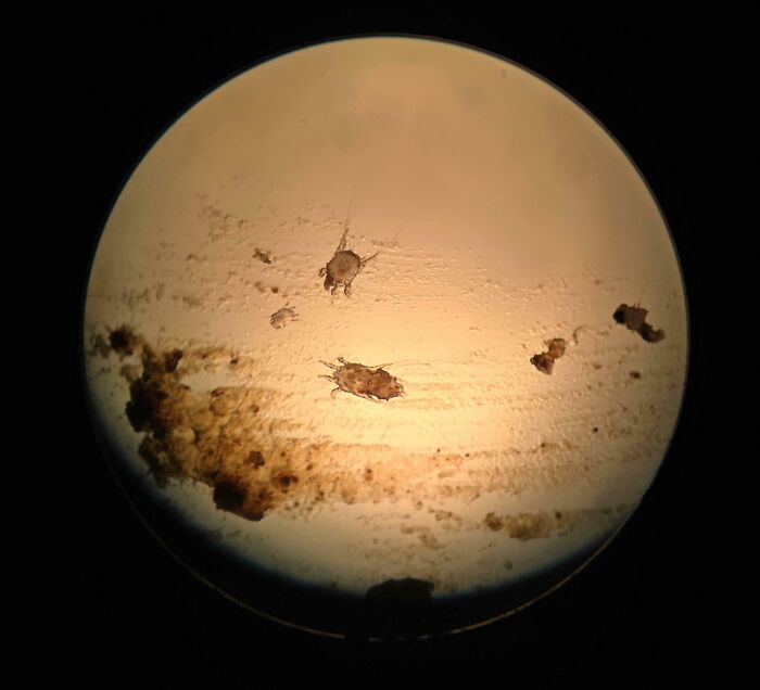Took A Picture Of Cat Ear Mites Under A Microscope