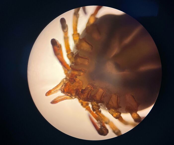 A Paralysis Tick Under A Microscope