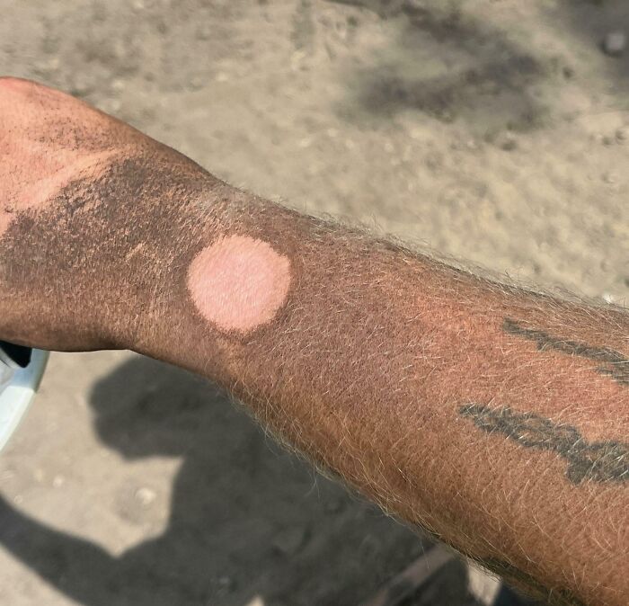 Close-up of an arm with an unusual circular patch of pale skin, one of the creepy and weird photos to get the heebie-jeebies.