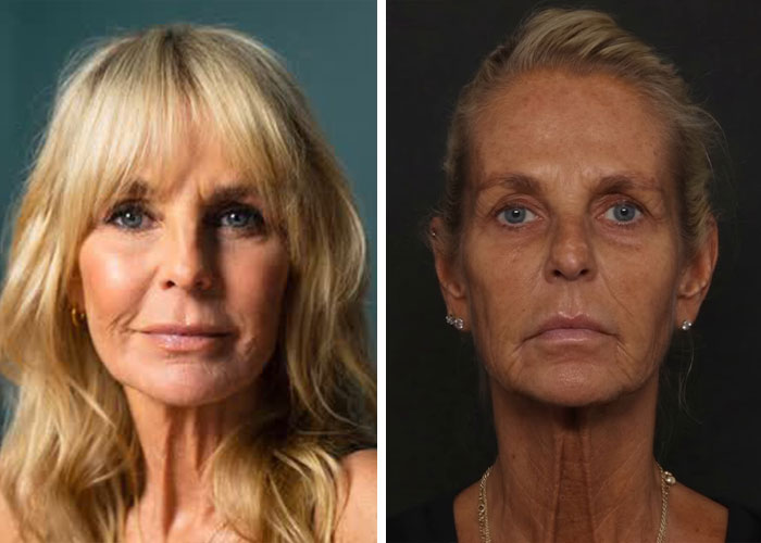 Ulrika Jonsson, 58, revela os seis meses de tratamento por trás de sua transformação dramática Ulrika Jonsson, 58, revela os seis meses de tratamento por trás de sua transformação dramática